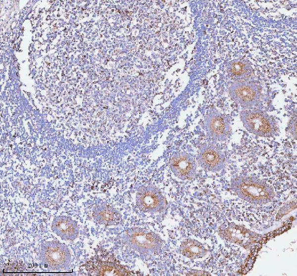  IHC analysis of HERP/HERPUD1 using anti-HERP/HERPUD1 antibody (A04908-2)