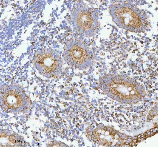  IHC analysis of HERP/HERPUD1 using anti-HERP/HERPUD1 antibody (A04908-2)