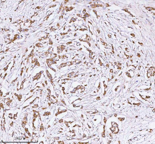 a04908 2 herpud1 primary antibodies ihc testing 4