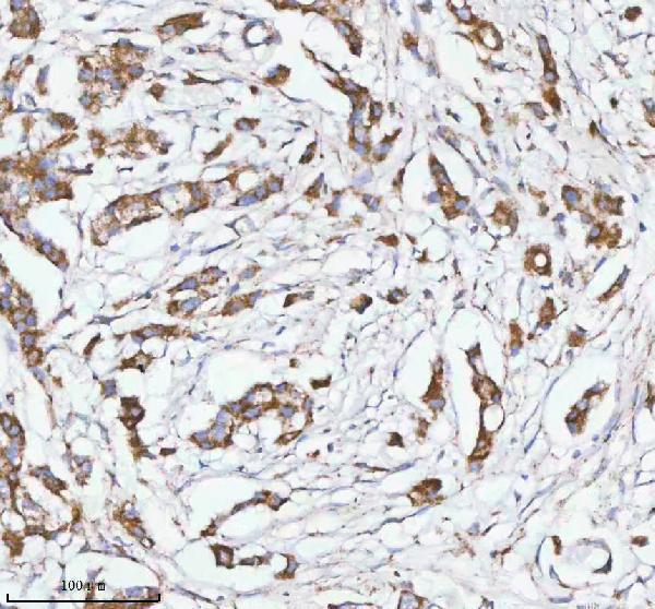 a04908 2 herpud1 primary antibodies ihc testing 5