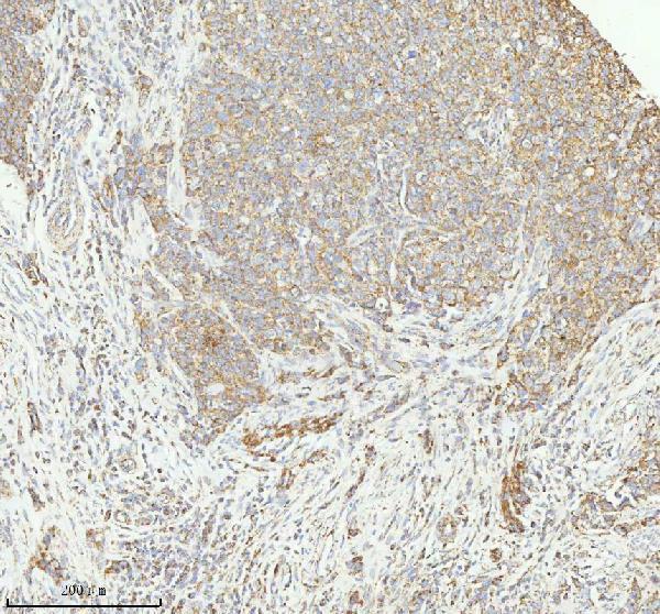 a04908 2 herpud1 primary antibodies ihc testing 6