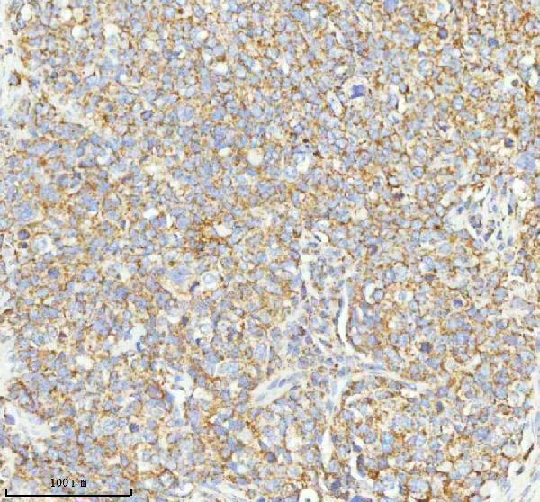 a04908 2 herpud1 primary antibodies ihc testing 7