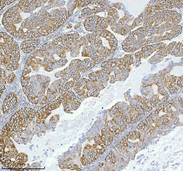 a04908 2 herpud1 primary antibodies ihc testing 8