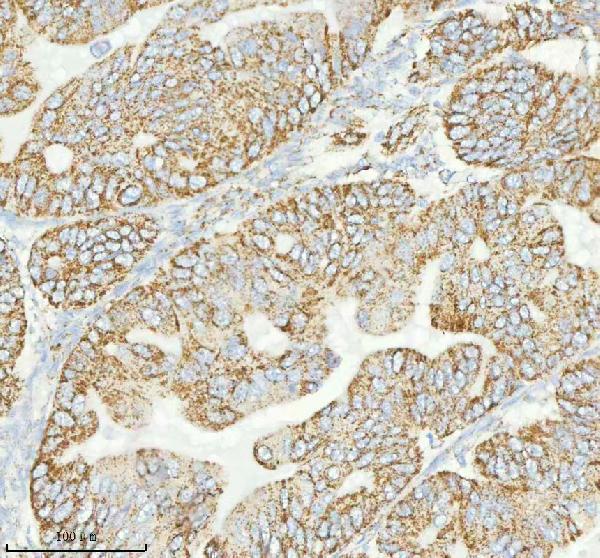 a04908 2 herpud1 primary antibodies ihc testing 9
