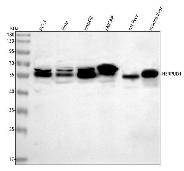  Western blot analysis of HERP/HERPUD1 using anti-HERP/HERPUD1 antibody (A04908-2)