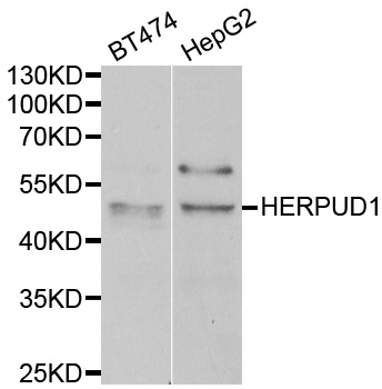 Western blot analysis of extracts of various cell lines, using HERPUD1 antibody