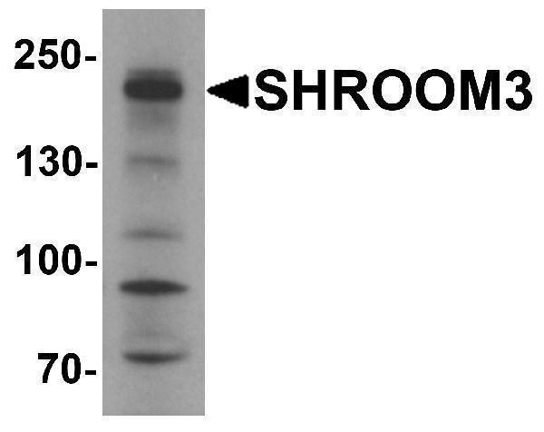 a04911 shroom3 primary antibodies wb testing 1