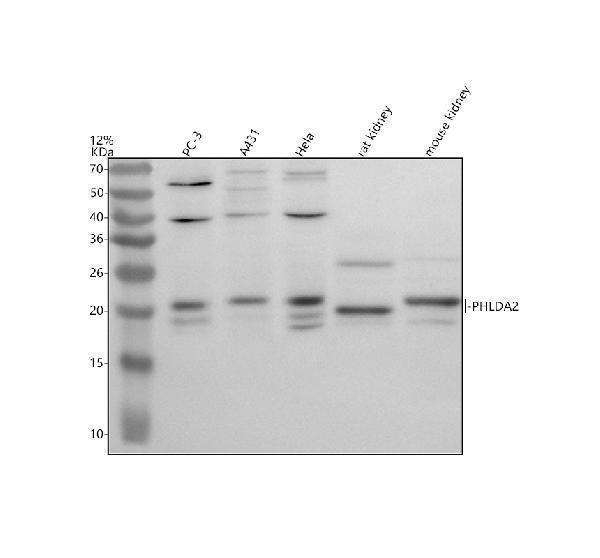 Western blot analysis of PHLDA2 using anti-PHLDA2 antibody (A04912-3)