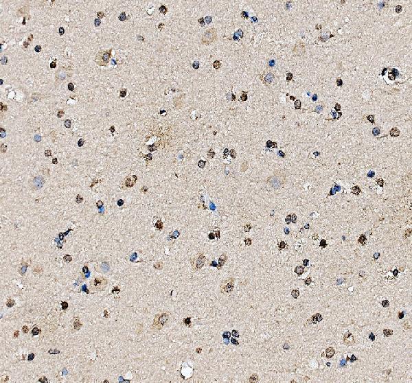 IHC analysis of SEC5/EXOC2 using anti-SEC5/EXOC2 antibody (A04913-2)