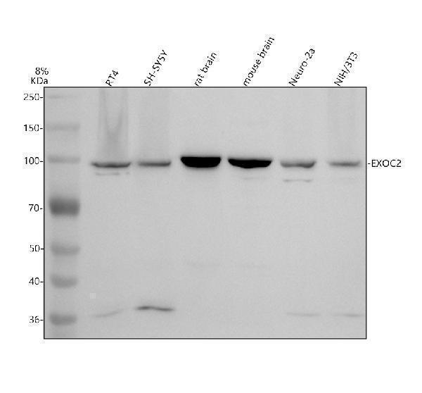 Western blot analysis of SEC5/EXOC2 using anti-SEC5/EXOC2 antibody (A04913-2)