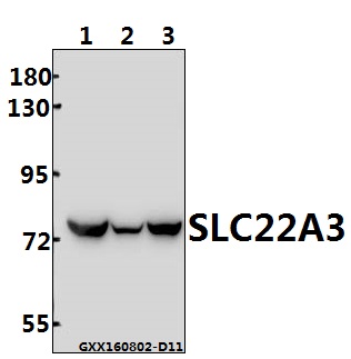 Western blot (WB) analysis of SLC22A3 (Q306) polyclonal antibody at 1:500 dilution
Lane1:786-O whole cell lysate(40ug)
Lane2:L02 whole cell lysate(40ug)
Lane3:HEK293T whole cell lysate(40ug)