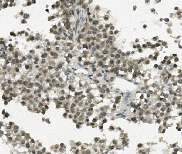 a04915 2 rec8 primary antibodies ihc testing 3