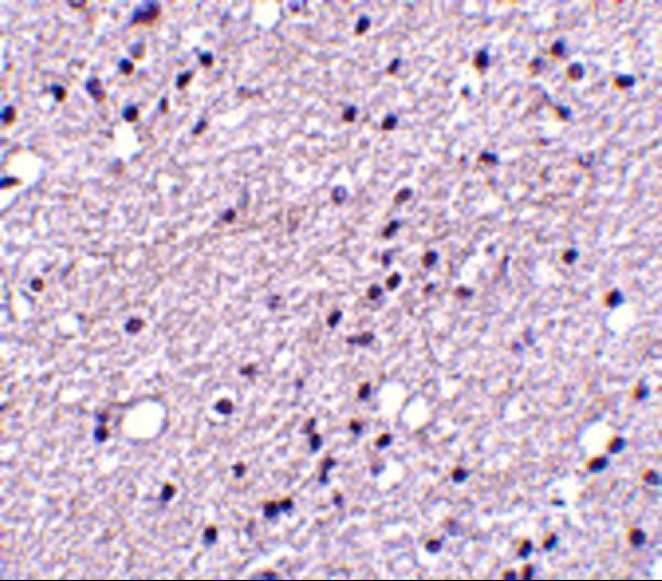 Immunohistochemistry of NK3R in human brain tissue with NK3R antibody at 5 μg/mL