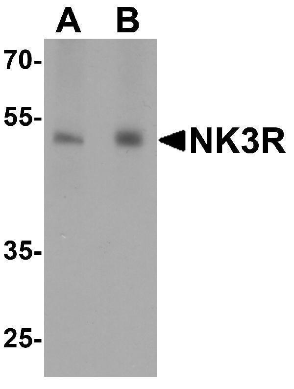 Western blot analysis of NK3R in RAW264