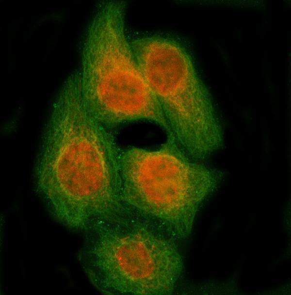  IF analysis of RBM14 using anti-RBM14 antibody (A04917-2) and anti-Tubulin Alpha antibody (M03989-3)