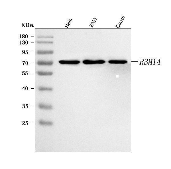  Western blot analysis of RBM14 using anti-RBM14 antibody (A04917-2)