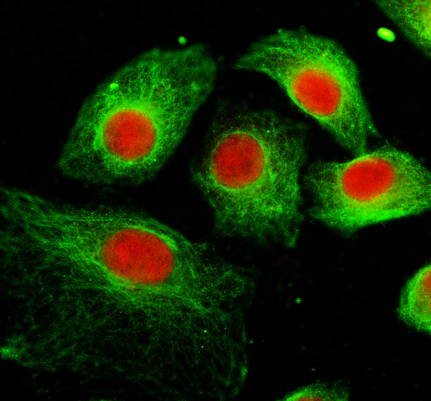 a04918 1 sgk2 primary antibodies if testing 1