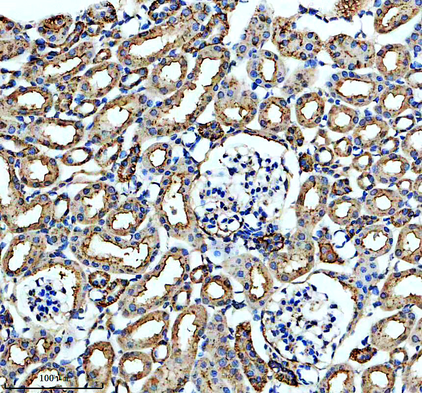 a04918 1 sgk2 primary antibodies ihc testing 1