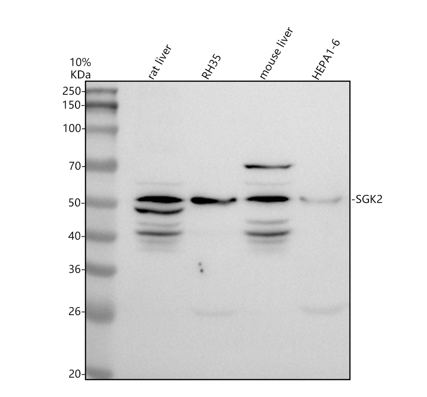 a04918 1 sgk2 primary antibodies wb testing 1