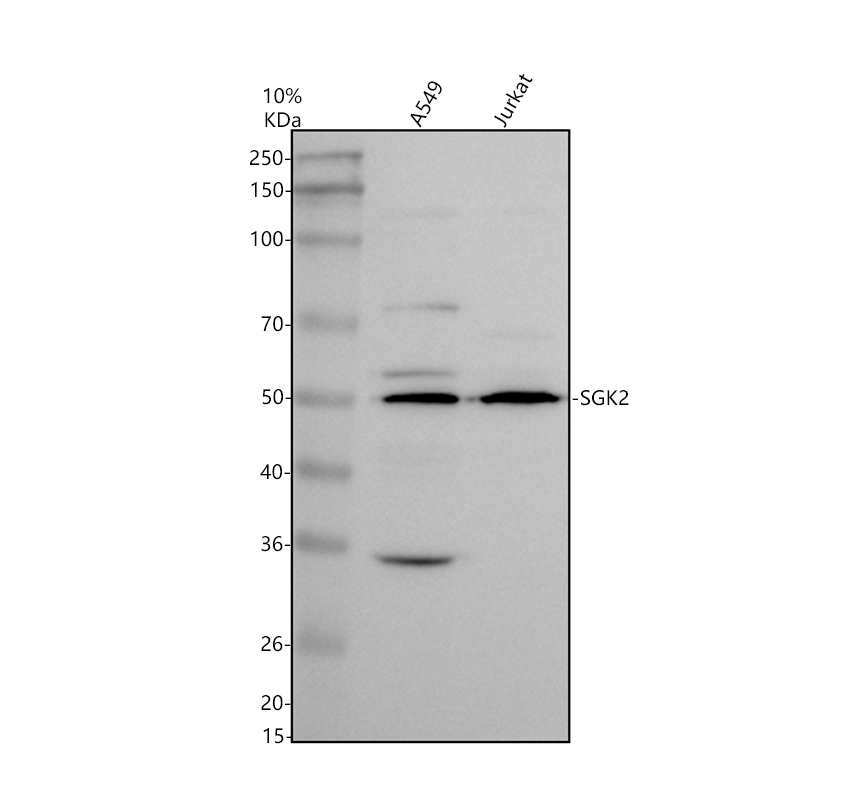 a04918 1 sgk2 primary antibodies wb testing 2