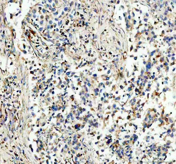 a04920 1 ndufs1 primary antibodies ihc testing 1