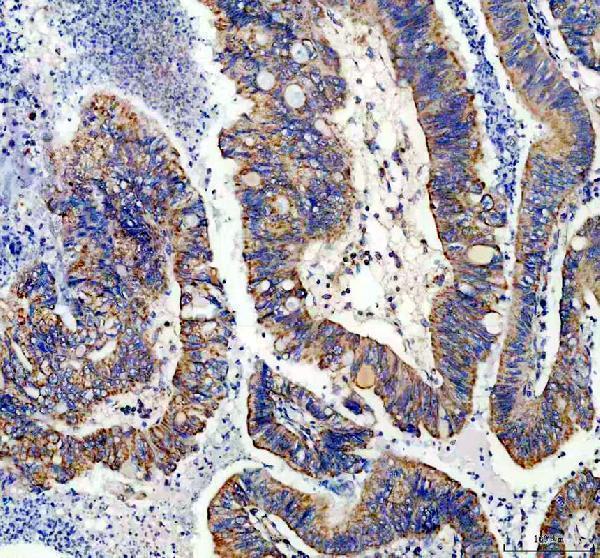 a04920 1 ndufs1 primary antibodies ihc testing 2