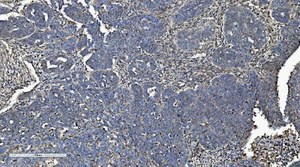  IHC analysis of LOC134147/CMBL using anti-LOC134147/CMBL antibody (A04921-1)