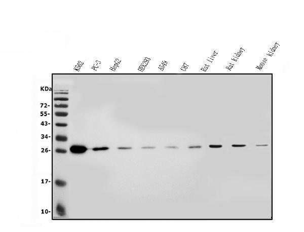  Western blot analysis of LOC134147/CMBL using anti-LOC134147/CMBL antibody (A04921-1)