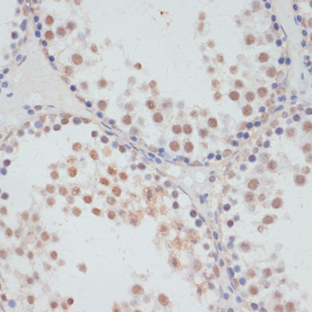 a04922s376 rps6ka5 primary antiboties ihc testing 2