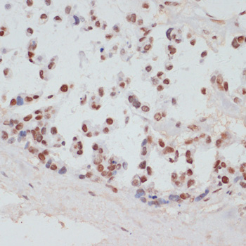 a04922s376 rps6ka5 primary antiboties ihc testing 3