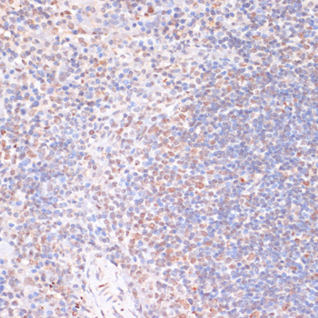 a04922s376 rps6ka5 primary antiboties ihc testing 4