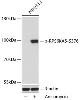 a04922s376 rps6ka5 primary antiboties wb testing 1