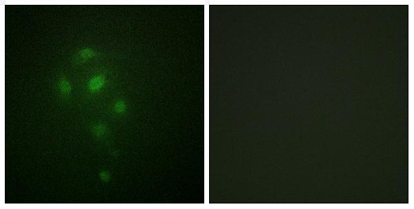 a04922t581 1 rps6ka5 primary antibodies if testing 4