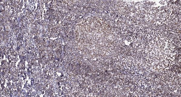 a04922t581 1 rps6ka5 primary antibodies ihc testing 3