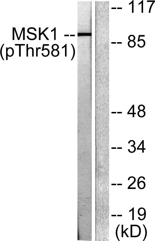 a04922t581 1 rps6ka5 primary antibodies wb testing 2