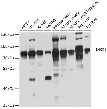Western blot analysis of extract of various cells, using MKS1 antibody