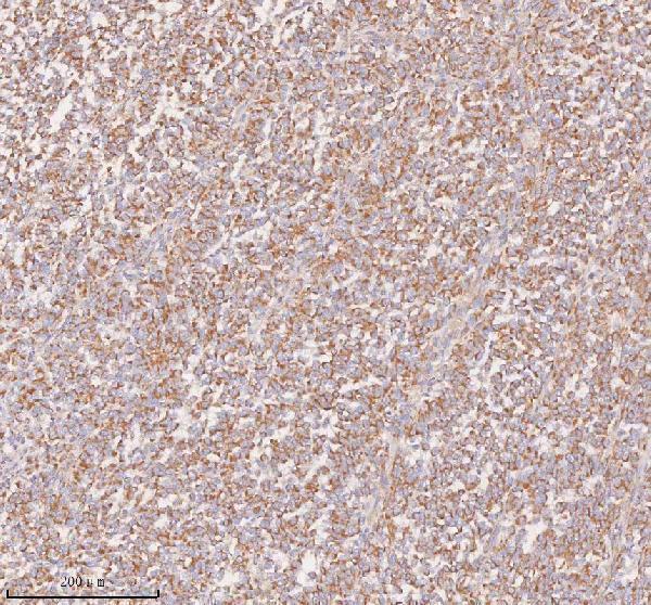  IHC analysis of UT-B/SLC14A1 using anti-UT-B/SLC14A1 antibody (A04926-2)