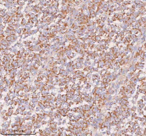 IHC analysis of UT-B/SLC14A1 using anti-UT-B/SLC14A1 antibody (A04926-2)