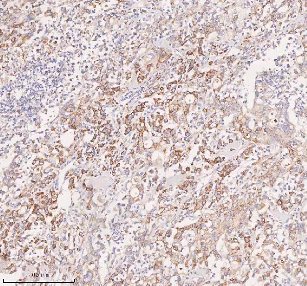 a04926 2 slc14a1 primary antibodies ihc testing 4