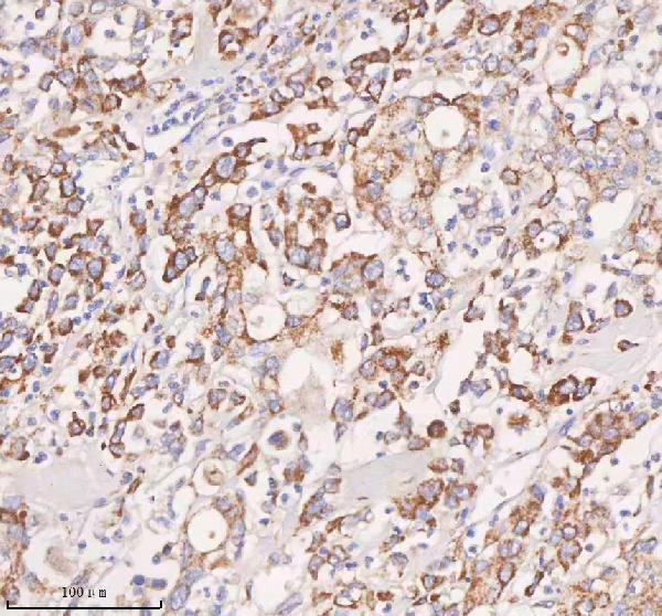 a04926 2 slc14a1 primary antibodies ihc testing 5