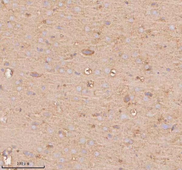 a04926 2 slc14a1 primary antibodies ihc testing 7