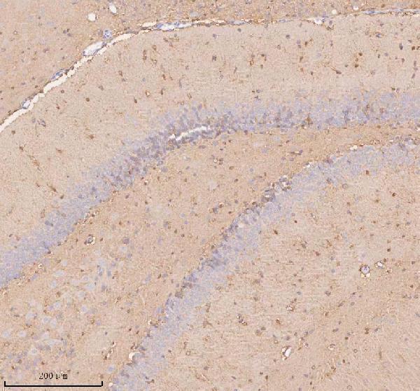 a04926 2 slc14a1 primary antibodies ihc testing 8