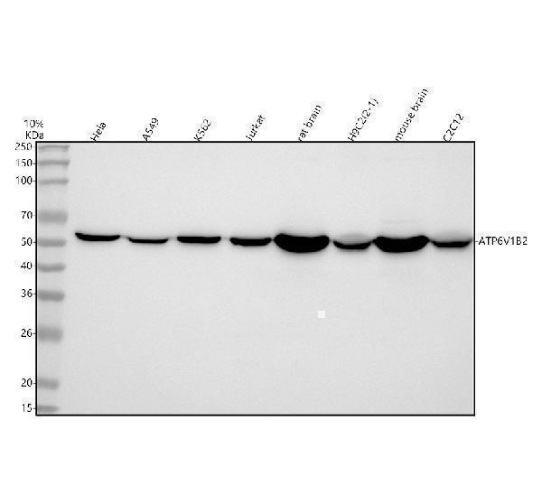  Western blot analysis of ATP6V1B2 using anti-ATP6V1B2 antibody (A04927-1)