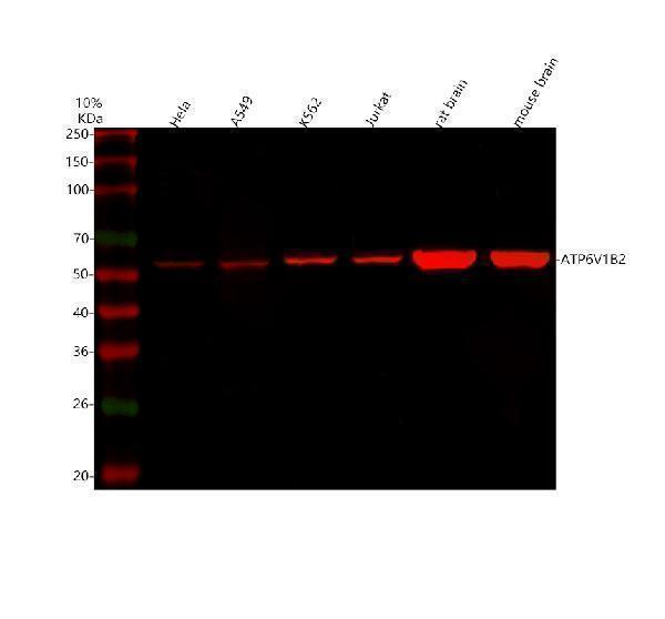  Western blot analysis of ATP6V1B2 using anti-ATP6V1B2 antibody (A04927-1)