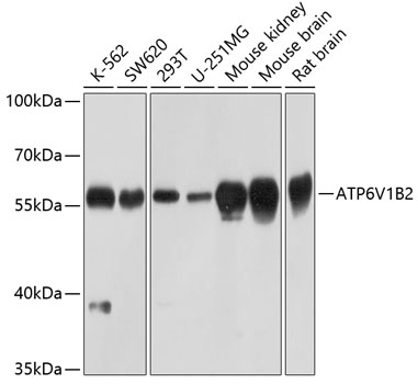 a04927 atp6v1b2 primary antiboties wb testing 1