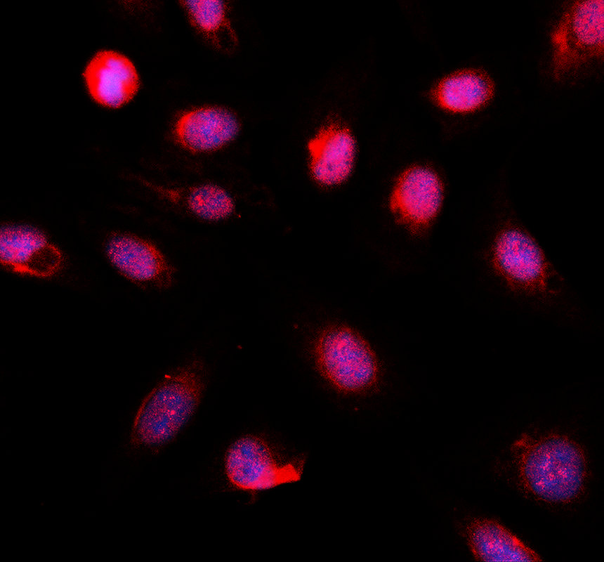 IF analysis of ABCC11 using anti-ABCC11 antibody (A04931-2) and anti-Alpha Tubulin antibody (M03989-3)