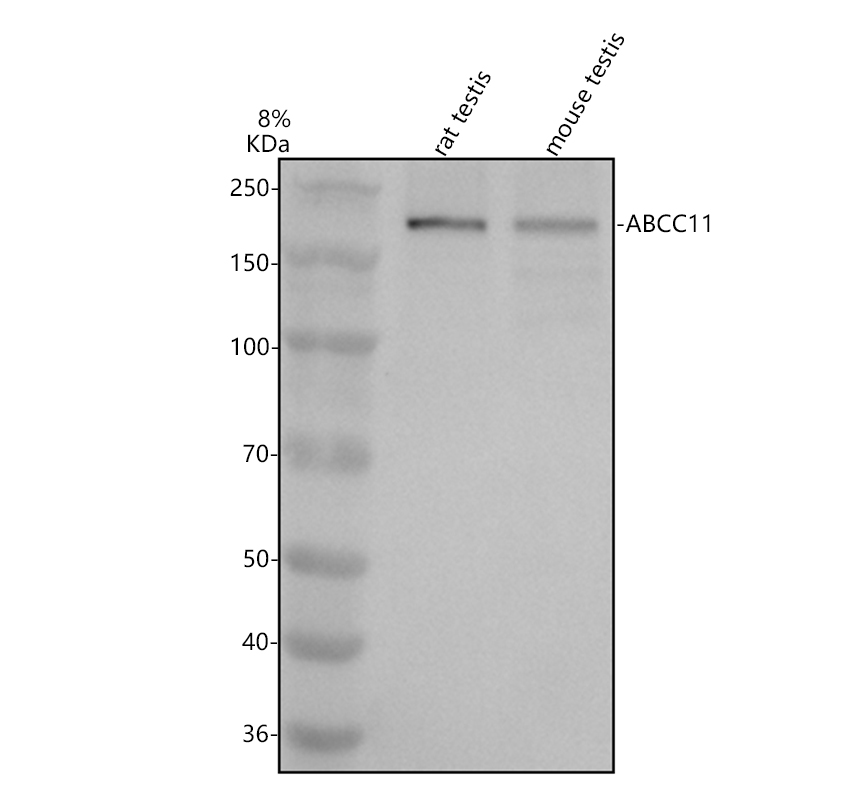Western blot analysis of ABCC11 using anti-ABCC11 antibody (A04931-2)