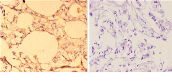 a04931 abcc11 primary antiboties ihc testing 2