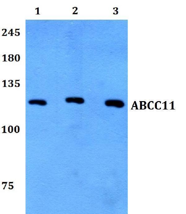 a04931 abcc11 primary antiboties wb testing 1