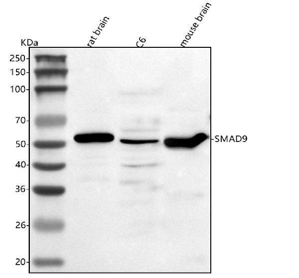  Western blot analysis of Smad9 using anti-Smad9 antibody (A04932-1)